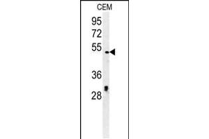 Western blot analysis in CEM cell line lysates (35ug/lane). (DSCC1 Antikörper  (C-Term))