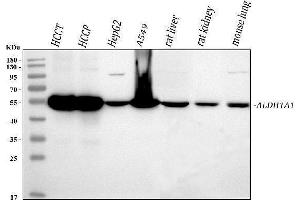 Western blot analysis of ALDH1A1 using anti-ALDH1A1 antibody (ABIN7602127).