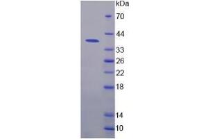 SDS-PAGE analysis of Human Nuclear Factor kappa B Protein. (NFkB Protein)