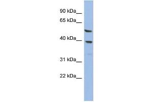 WB Suggested Anti-OLAH Antibody Titration: 0. (OLAH Antikörper  (N-Term))