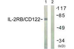 Western blot analysis of extracts from COS7 cells, using IL-2R beta/CD122 (Ab-364) Antibody. (IL2 Receptor beta Antikörper  (AA 331-380))