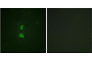 Immunofluorescence staining of methanol-fixed HuvEc cells using SNAI1 (Phospho-Ser246) Antibody. (SNAIL Antikörper  (pSer246))