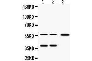Western Blotting (WB) image for anti-alpha-2-HS-Glycoprotein (AHSG) (AA 33-65), (N-Term) antibody (ABIN3043534) (Fetuin A Antikörper  (N-Term))