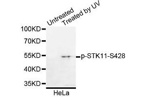 Western blot analysis of extracts of HeLa cells, using Phospho-STK11-S428 antibody (ABIN5995629). (LKB1 Antikörper  (pSer428))