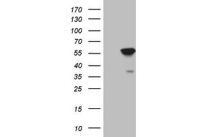 Western Blotting (WB) image for anti-4-Aminobutyrate Aminotransferase (ABAT) (AA 29-323) antibody (ABIN2715600) (ABAT Antikörper  (AA 29-323))