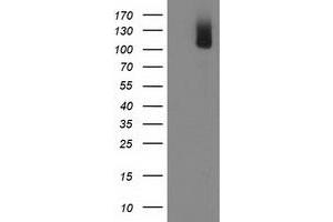 Western Blotting (WB) image for anti-phosphodiesterase 2A, CGMP-Stimulated (PDE2A) antibody (ABIN1500082) (PDE2A Antikörper)