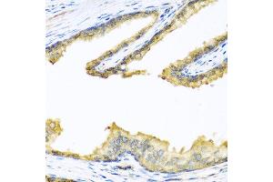 Immunohistochemistry of paraffin-embedded human prostate using PENK antibody at dilution of 1:100 (40x lens). (Enkephalin Antikörper)