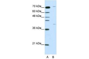 ZNF668 antibody (20R-1224) used at 0. (ZNF668 Antikörper  (C-Term))