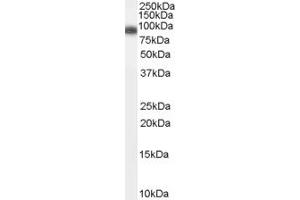 Western Blotting (WB) image for anti-ADAM Metallopeptidase Domain 23 (Adam23) (N-Term) antibody (ABIN2782599) (Adam23 Antikörper  (N-Term))