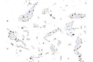 Immunocytochemistry (ICC) image for anti-Cyclin-Dependent Kinase Inhibitor 1A (p21, Cip1) (CDKN1A) (AA 100-150) antibody (ABIN7795764)