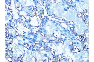 Immunohistochemistry of paraffin-embedded Mouse placenta using GLUT1/SLC2 antibody (ABIN6129475, ABIN6147954, ABIN6147956 and ABIN6222743) at dilution of 1:100 (40x lens). (GLUT1 Antikörper  (AA 210-310))