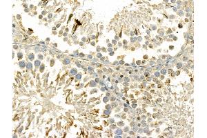 ABIN6261297 and ABIN6273041 at 1/100 staining Rat testis tissue by IHC-P. (DIAPH3 Antikörper  (Internal Region))