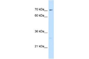 WB Suggested Antibody Titration:  5. (CTP Synthase Antikörper  (N-Term))