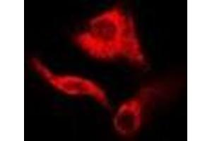 Immunofluorescent analysis of GDA staining in A549 cells. (GDA Antikörper)