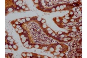 IHC image of ABIN7127787 diluted at 1:100 and staining in paraffin-embedded human small intestine tissue performed on a Leica BondTM system. (Rekombinanter Raptor Antikörper)