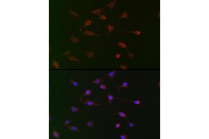 Immunofluorescence analysis of BALB-3T3 cells using CDC34 Rabbit pAb (ABIN6131558, ABIN6138257, ABIN6138258 and ABIN6221114) at dilution of 1:100 (40x lens). (CDC34 Antikörper  (AA 1-236))