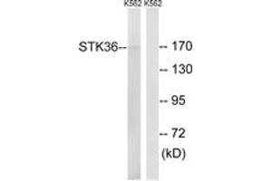 Western Blotting (WB) image for anti-serine/threonine Kinase 36 (STK36) (AA 387-436) antibody (ABIN2879207) (STK36 Antikörper  (AA 387-436))