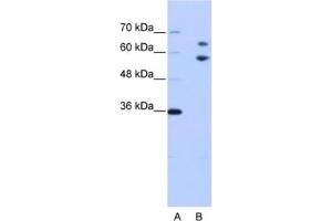 Western Blotting (WB) image for anti-TROVE Domain Family, Member 2 (TROVE2) antibody (ABIN2462170) (TROVE2 Antikörper)