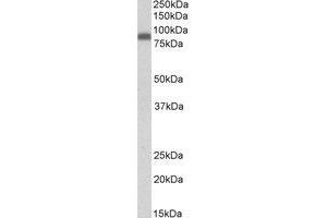 Image no. 1 for anti-Zyxin (ZYX) (AA 327-339) antibody (ABIN466851) (ZYX Antikörper  (AA 327-339))
