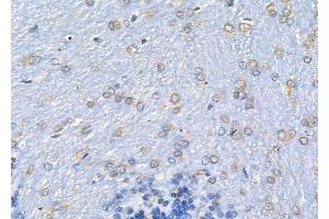 ABIN6262435 and ABIN6278088 at 1/100 staining Rat brain tissue by IHC-P.