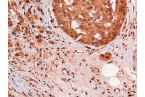 Immunohistochemistry (IHC) image for anti-Ubiquitin (Ub) (AA 1-229) antibody (ABIN7428593)