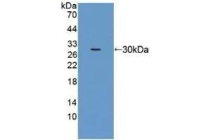 Detection of Recombinant EEF1a1, Human using Polyclonal Antibody to Eukaryotic Translation Elongation Factor 1 Alpha 1 (EEF1a1) (eEF1A1 Antikörper  (AA 1-241))