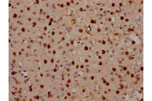 IHC image of ABIN7150394 diluted at 1:100 and staining in paraffin-embedded human brain tissue performed on a Leica BondTM system. (SATB2 Antikörper  (AA 228-369))