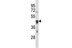 ARC antibody western blot analysis in K562 lysate. (ARC (AA 37-66) Antikörper)