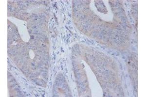 Immunohistochemistry of paraffin-embedded human placenta tissue using ABIN7156785 at dilution of 1:100 (IL12B Antikörper  (AA 23-328))