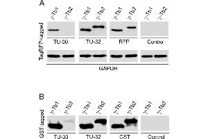 Western blotting analysis of differential reactivity of monoclonal antibodies to γ-tubulin with human γ-tubulin isotypes.