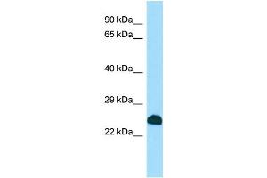 WB Suggested Anti-SCNM1 Antibody Titration: 1.