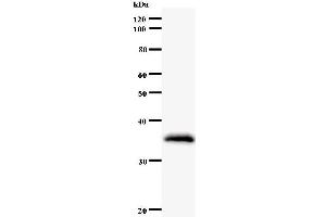 Western Blotting (WB) image for anti-Zinc Finger Protein 354A (ZNF354A) antibody (ABIN933131)