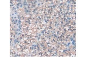 Immunohistochemistry (IHC) image for anti-T Cell Immunoreceptor with Ig and ITIM Domains (TIGIT) (AA 21-234) antibody (ABIN7439486)