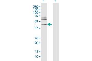 Western Blot analysis of FOXP3 expression in transfected 293T cell line by FOXP3 MaxPab polyclonal antibody. (FOXP3 Antikörper  (AA 1-431))