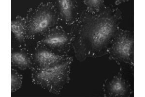 Immunofluorescent staining of A549 cells. (FAK Antikörper  (pTyr397))