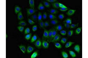 Immunofluorescent analysis of A549 cells using ABIN7154745 at dilution of 1:100 and Alexa Fluor 488-congugated AffiniPure Goat Anti-Rabbit IgG(H+L) (GNB5 Antikörper  (AA 1-353))