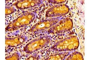 Immunohistochemistry (IHC) image for anti-Neuronal PAS Domain Protein 2 (NPAS2) (AA 644-763) antibody (ABIN7161386)