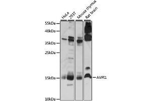Western blot analysis of extracts of various cell lines, using AVPI1 antibody (ABIN6292453) at 1:1000 dilution.