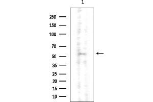 anti-CCR4-NOT Transcription Complex, Subunit 4 (CNOT4) (N-Term) antibody