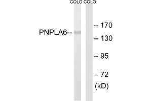 Western blot analysis of extracts from COLO205 cells, using PNPLA6 antibody. (PNPLA6 Antikörper  (N-Term))