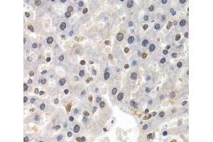 Immunohistochemistry of paraffin-embedded Rat liver using GTF2F1 Polyclonal Antibody at dilution of 1:200 (40x lens).