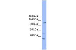 Image no. 1 for anti-StAR-Related Lipid Transfer (START) Domain Containing 8 (STARD8) (AA 201-250) antibody (ABIN6746633) (STARD8 Antikörper  (AA 201-250))