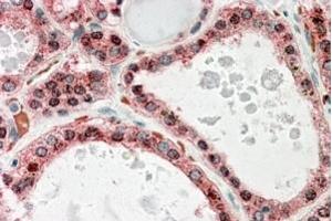 ABIN571061 (3. (KCNN2 Antikörper  (Internal Region))
