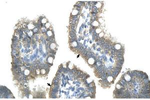 Human Intestine; ZNF498 antibody - middle region in Human Intestine cells using Immunohistochemistry (Zinc Finger and SCAN Domain Containing 25 (ZSCAN25) (Middle Region) Antikörper)