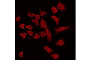 ABIN6269391 staining MDA-MB-435 by IF/ICC. (ASK1 Antikörper  (N-Term))