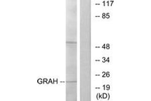 Western blot analysis of extracts from K562 cells, using GRAH Antibody. (GZMH Antikörper  (AA 51-100))