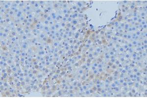 ABIN6273742 at 1/100 staining Mouse liver tissue by IHC-P. (CYP7A1 Antikörper  (Internal Region))