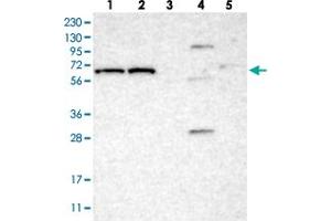 Western blot analysis of Lane 1: RT-4, Lane 2: U-251 MG, Lane 3: Human Plasma, Lane 4: Liver, Lane 5: Tonsil with IFFO2 polyclonal antibody . (IFFO2 Antikörper)