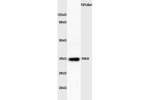 Mouse spleen lysates probed with Rabbit Anti-GATA-1 Polyclonal Antibody  at 1:3000 90min in 37˚C. (GATA1 Antikörper  (AA 251-350))