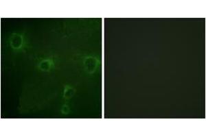 Immunofluorescence analysis of COS7 cells, using Kv2. (Kv2.1/KCNB1 Antikörper  (AA 533-582))